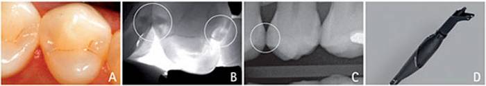 diagnocam caso 1