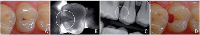 diagnocam caso 2