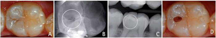 diagnocam caso 3